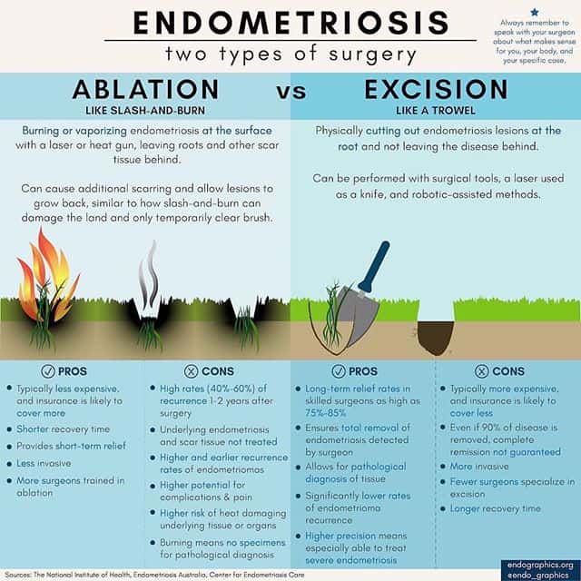 ablation v excision endometriosis